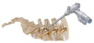 minimalinvasive-spine-surgery minimalinvasive-spine-surgery